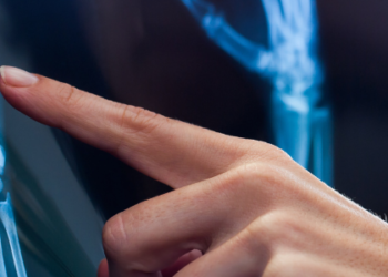 Vai agli articoli Digital health: ultimi giorni di raccolta per Bes Test!
